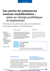 antérieure -caractéristiques -valeur -influence lésion