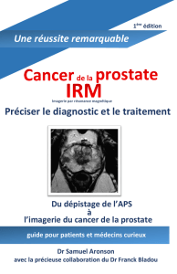 IRM de la prostate
