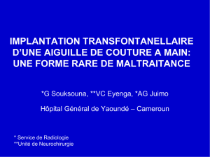IMPLANTATION TRANSFONTANELLAIRE D`UNE AIGUILLE DE