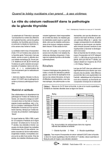 Le rôle du césium radioactif dans la pathologie de la glande thyroïde
