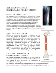 ablation du fémur diaphysaire pour tumeur