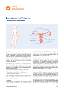 Le cancer de l`utérus - Carcinome de l`endomètre