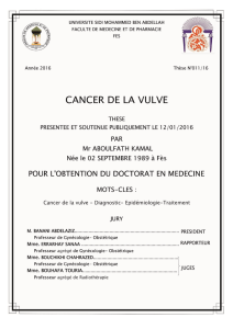 CANCER DE LA VULVE N° Thèse 011/16 Mr. KAMAL ABOULFATH 0