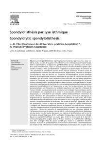 Spondylolisthésis par lyse isthmique Spondylolytic spondylolisthesis