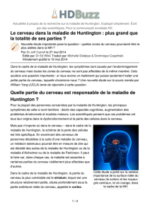 Le cerveau dans la maladie de Huntington