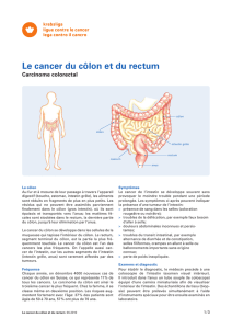 Le cancer du côlon et du rectum