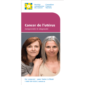 Cancer de l`utérus - nbbwcp