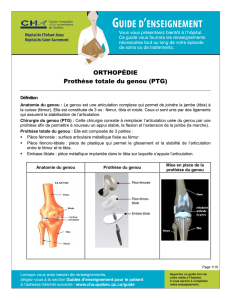 Prothèse totale du genou (PTG)