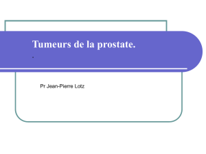 Cancer de la prostate - Présentation IFSI – UPMC