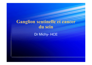 Ganglion sentinelle et cancer du sein
