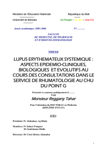 lupus erythemateux systemique : aspects epidemio
