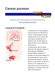 Cancer poumon - European Institute of Women`s Health