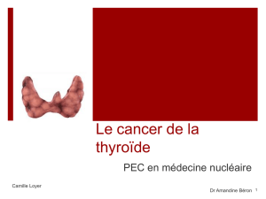 Le cancer de la thyroïde
