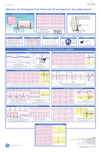 Détection de l`allongement de l`intervalle QT provoqué par des