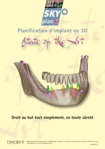 Planification d`implant en 3D
