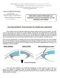 feuille d`information SFO sur l`extraction du cristallin pour les angles