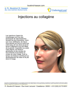 Injections au collagène - Mammoplastie