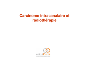 Radiothérapie des carcinomes intra canalaires (A. Fourquet)