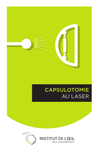 capsulotomie au laser - l`Institut de l`oeil