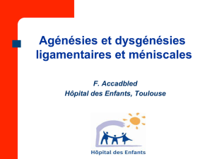 Agénésies et Dysgénésies Ligamentaires et Méniscales