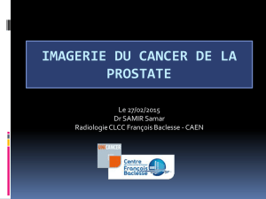 CAEN-SAMIR-IRM CANCER DE LA PROSTATE