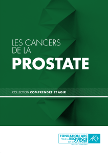 Les cancers de la prostate