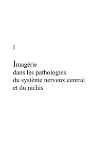 I Imagérie dans les pathologies du système nerveux - iPubli