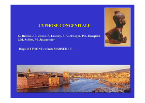 Cyphoses congénitales