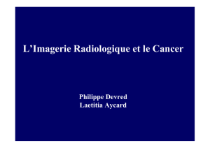 L`Imagerie Radiologique et le Cancer