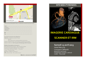 Imagerie cardiaque - (CHU) de Toulouse