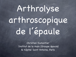 Arthrolyse arthroscopique épaule Ch. Dumontier