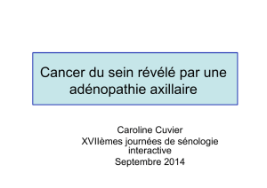 St Louis 2014 Cuvier C. Cancer sein révélé par une adénopathie