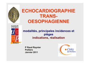 echocardiographie trans- oesophagienne