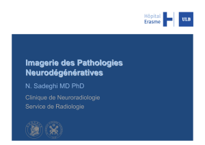 Pathologies neurodégénératives
