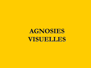 agnosies visuelles
