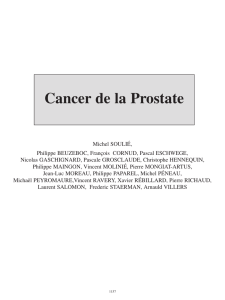 Cancer de la Prostate