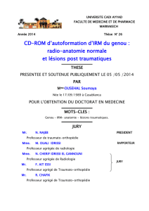 CD-ROM d`autoformation d`IRM du genou : radio