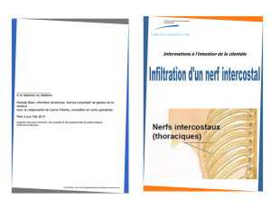 Infiltration d`un nerf intercostal