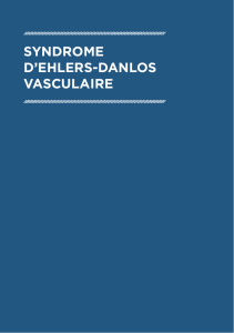 syndrome d`ehlers-danlos vasculaire - FAVA