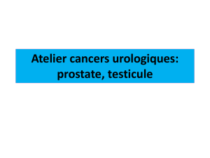 Cancer urologique (prostate et testicule)