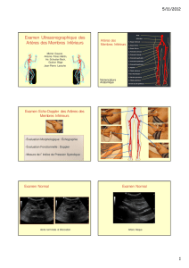 Examen Ultrasonographique des Artères des Membres Inférieurs