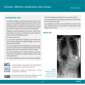 Scolioses : définition, classifications, bilan clinique - OER