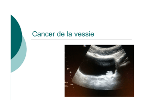 2016 - Cancer de la vessie