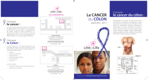 C`est quoi le cancer du côlon