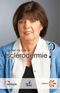 Qu`est-ce que la sclérodermie?