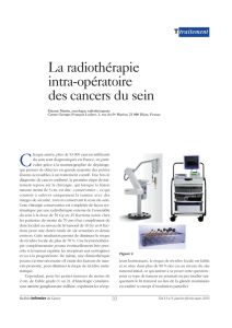 La radiothérapie intra-opératoire des cancers du sein