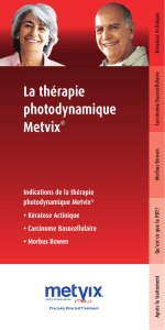 La thérapie photo dynamique Metvix