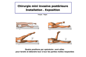 Chirurgie mini-invasive postérieure en dessins