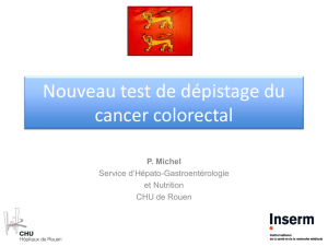 Nouveau test de dépistage du cancer colorectal