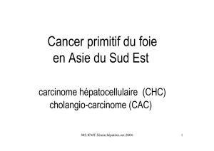 Cancer primitif du foie / Carcinome hépato
